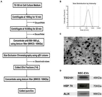 Neural stem cell-derived extracellular vesicles favour neuronal differentiation and plasticity under stress conditions